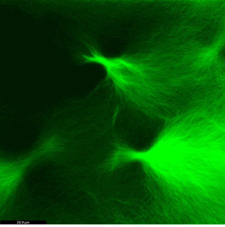 Micrograph captured by Laser Scanning Confocal Microscopy (LSCM).